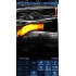 Беспроводной ветеринарный конвексионно-линейный УЗИ сканер UProbe-C5DC